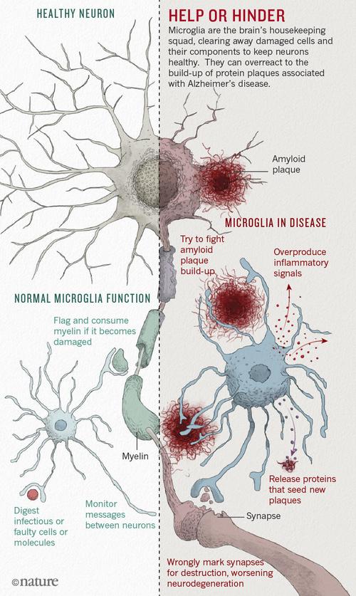 alzheimer’s cro,Understanding Alzheimer’s Disease: A Comprehensive Guide for You