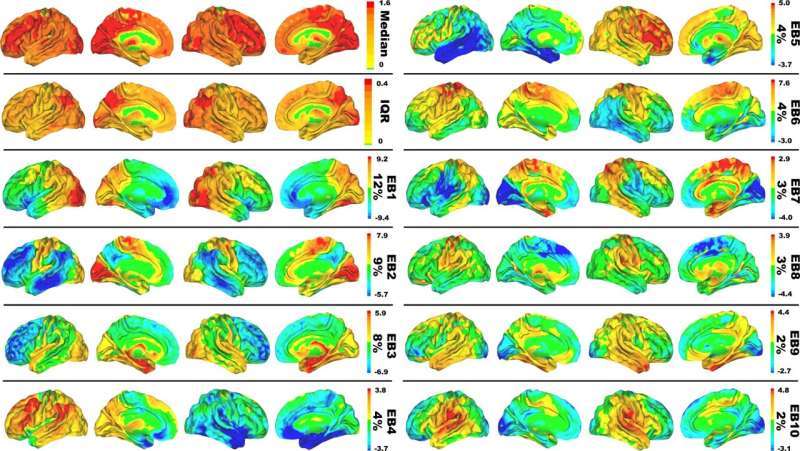 alzheimer’s research cro,Understanding Alzheimer’s Research at Cro