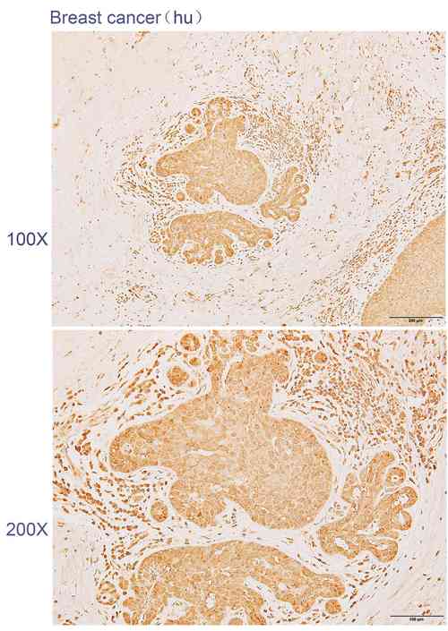 antibody purification cro,Understanding Antibody Purification: A Comprehensive Guide for Researchers