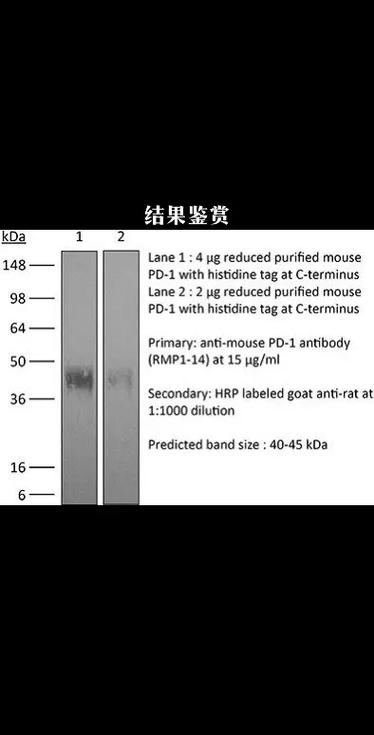 antibody cro discovery,Understanding Antibody-CRISPR Discovery: A Comprehensive Guide