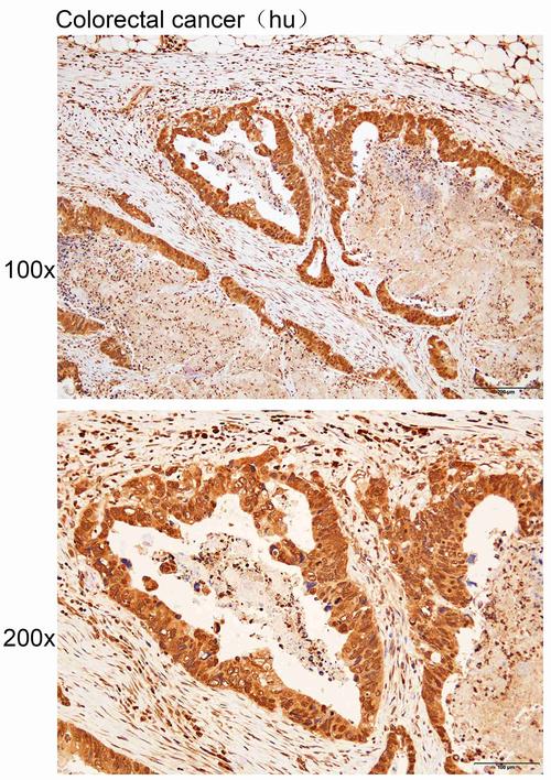 antibody cro,Understanding Antibody-CRISPR: A Comprehensive Guide